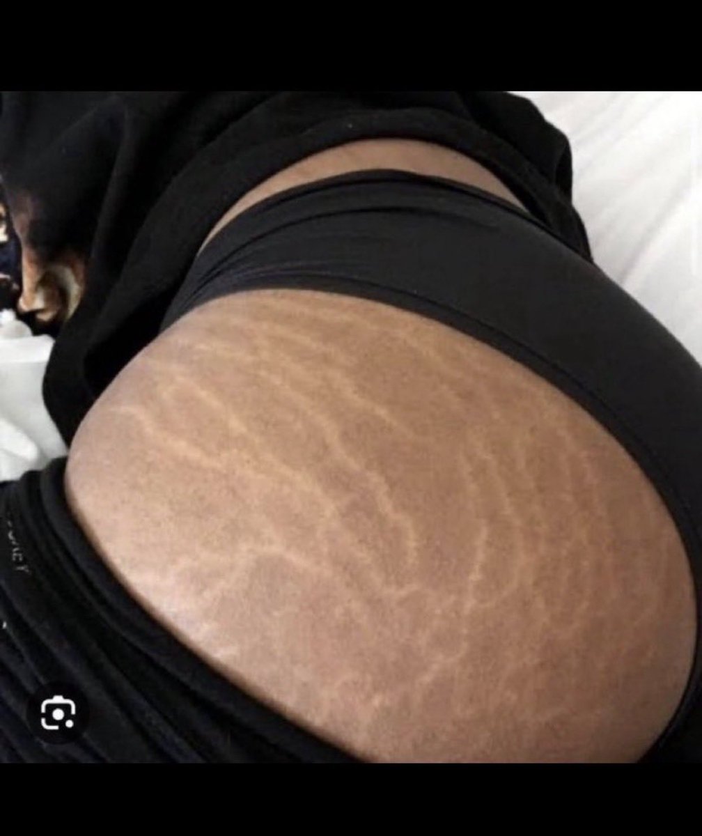 This is what Mavo meant by “ur body na meat pie”😂