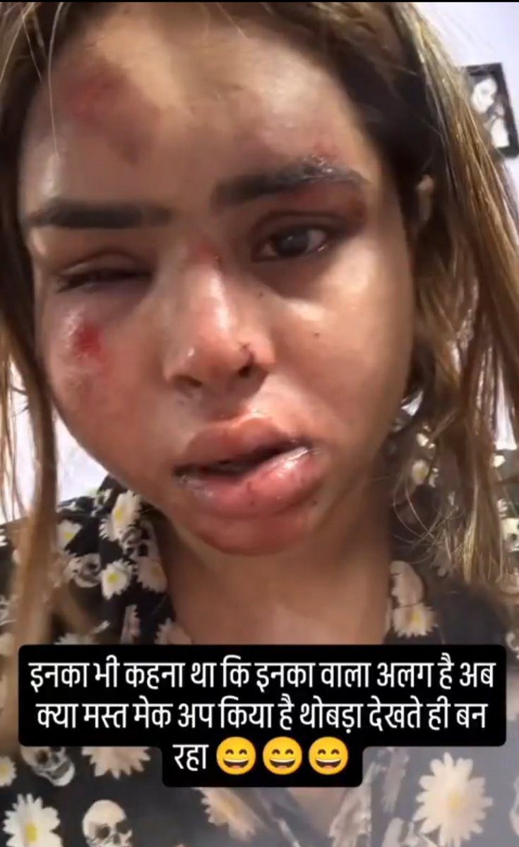 अब्दुल ने पूरा थोबड़ा ही बदल दिया ! 😭