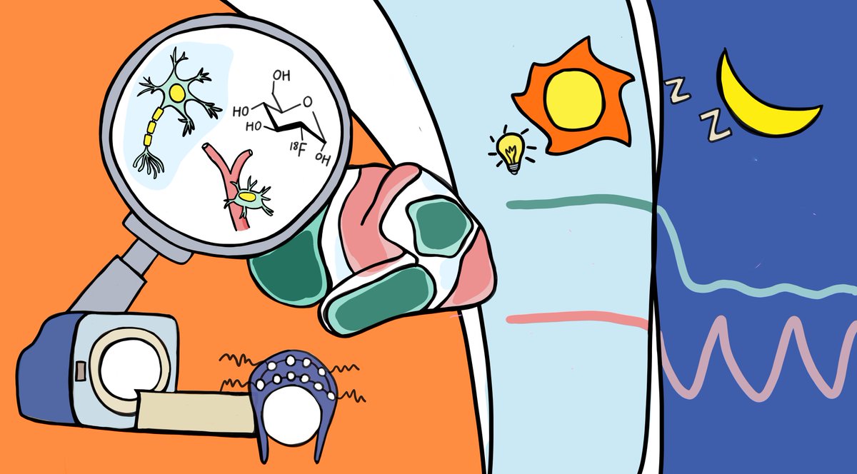 candy_lab_'s tweet photo. A multi-year project finally comes out! Using EEG-fPET-fMRI, we reveal the intricate coordination of diverse physiological processes during the descent into NREM sleep and the cortical pathway facilitating sensory awakening! @MGHMartinos @NatureComms  https://t.co/5VbXm3Ygbi https://t.co/F7Ydth05Po