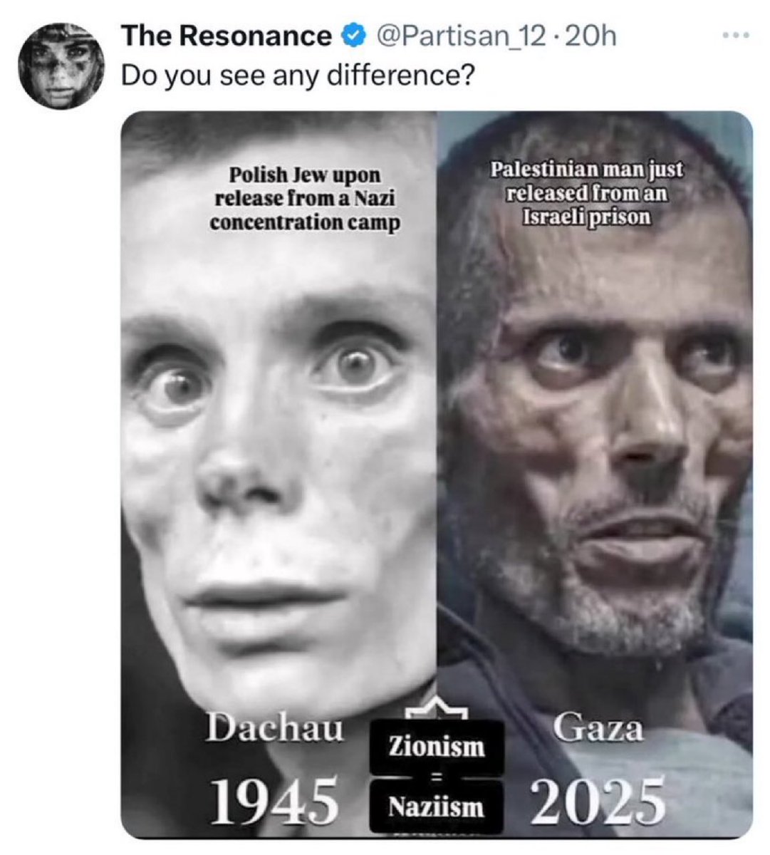 EYakoby's tweet image. Yes, the Palestinian is a cancer patient who was treated by Zionist doctors to save him.
Thank you for your attention to this matter.