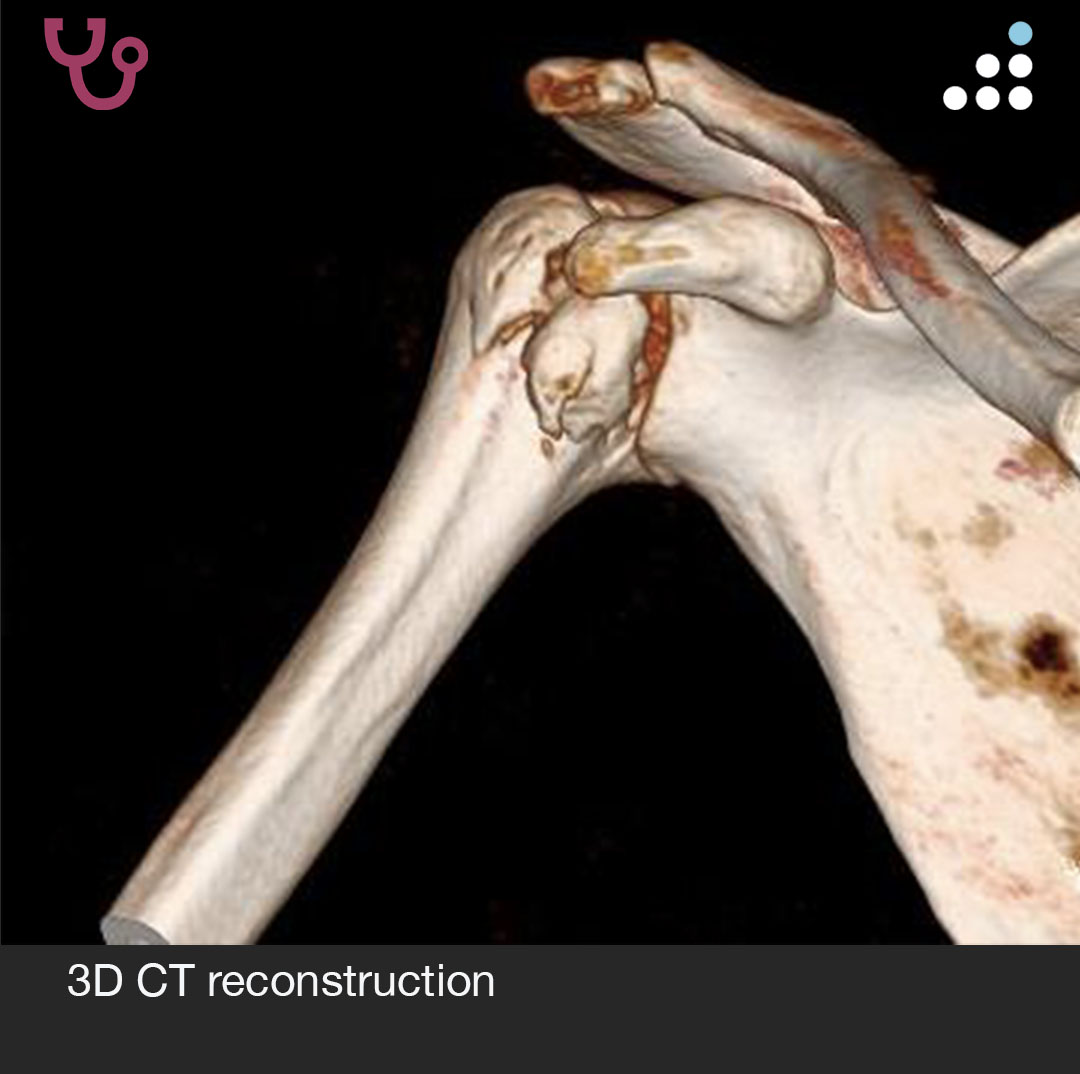 Orthobullets tweet media