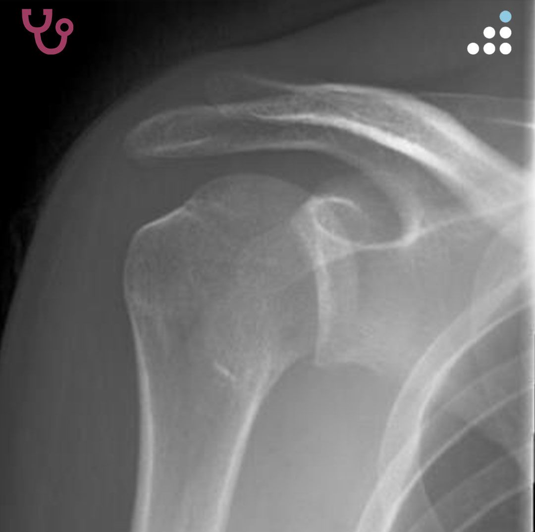 Orthobullets tweet media