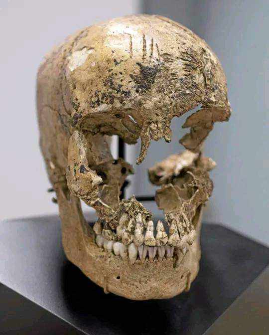 The skull of a 14 year-old girl believed to be a victim of cannibalism at the Jamestown colony in the winter of 1609 CE. Butchery marks can be seen on forehead -

In 2013; Archaeologists confirmed, that Jamestown's colonists resorted to cannibalism during the "starving time"