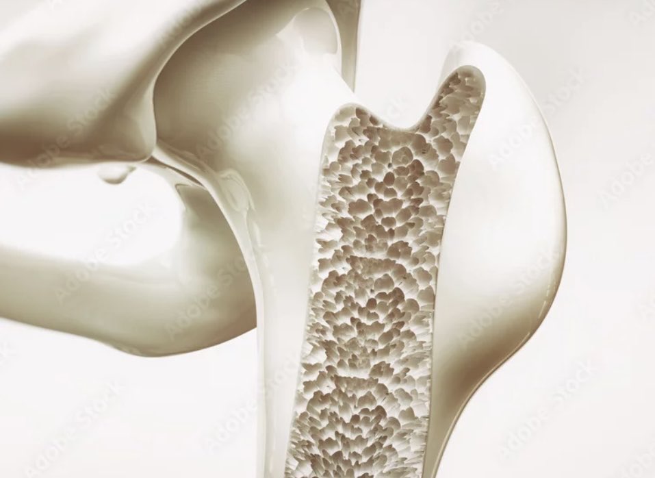 骨は栄養と運動で強くなるよ

でも動かない、食べないで痩せると栄養不足になったり、骨にかかる負担が小さくなって骨が弱くなっちゃう
女性は閉経後に一気に骨密度が下がり骨粗しょう症になりやすいため注意が必要なんだ
だから、しっかり動いてしっかり食べて、筋肉と骨を鍛えようね
#筋トレ