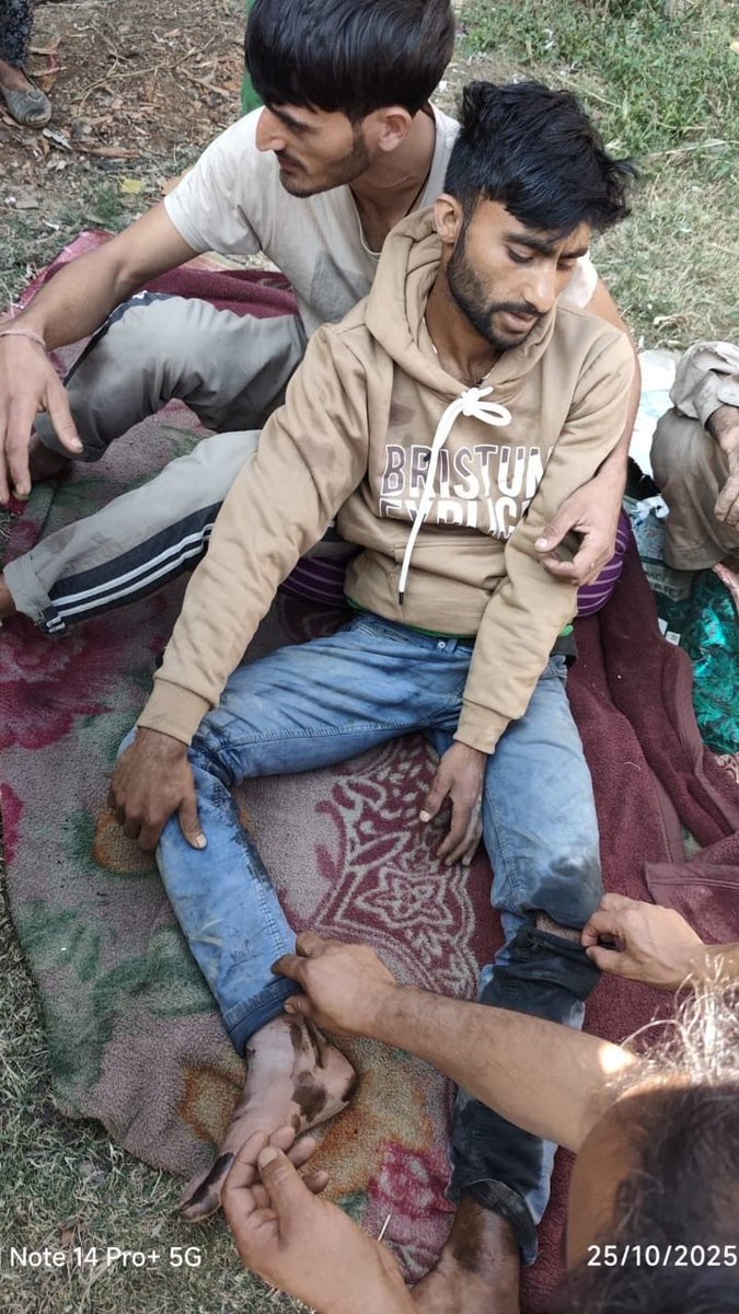 abid_hussain017's tweet image. 🚨 Accident at Adbais 💔
Mohd Amin Nayiak from Dewal Bachalla, Mahore got seriously injured.
He belongs to a poor family — we appeal to @erkhurshied &amp;amp; @DMReasi @MahoreSub to help him and fix this dangerous road before another life is lost. 🙏
#Reasi #RoadSafety
#accident