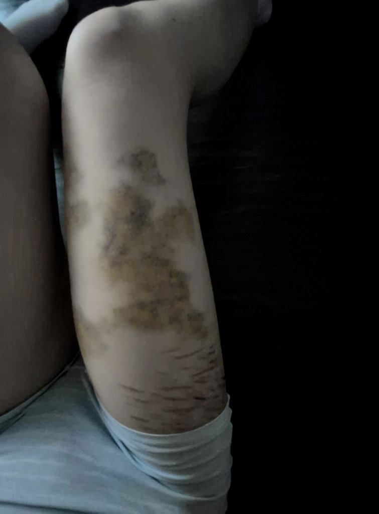 cutegirlvomit's tweet image. ( ,,⩌'︿'⩌,,)