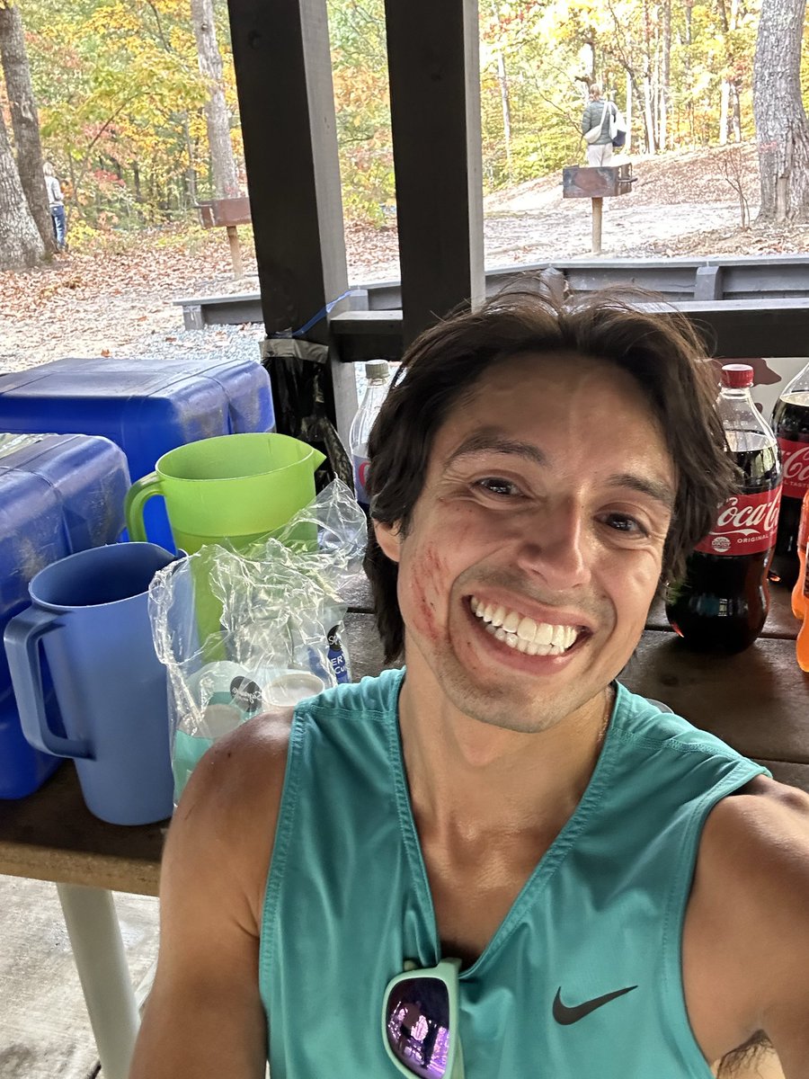 matthew_kopf's tweet photo. @UltraRunner26 31.48 (50K ultra). Pretty banged up. Sticking to road for a while. These trail runners are tough. https://t.co/oPPHUQ8AHW