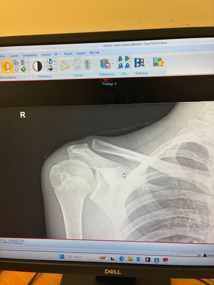 Lewis Barton tweet media