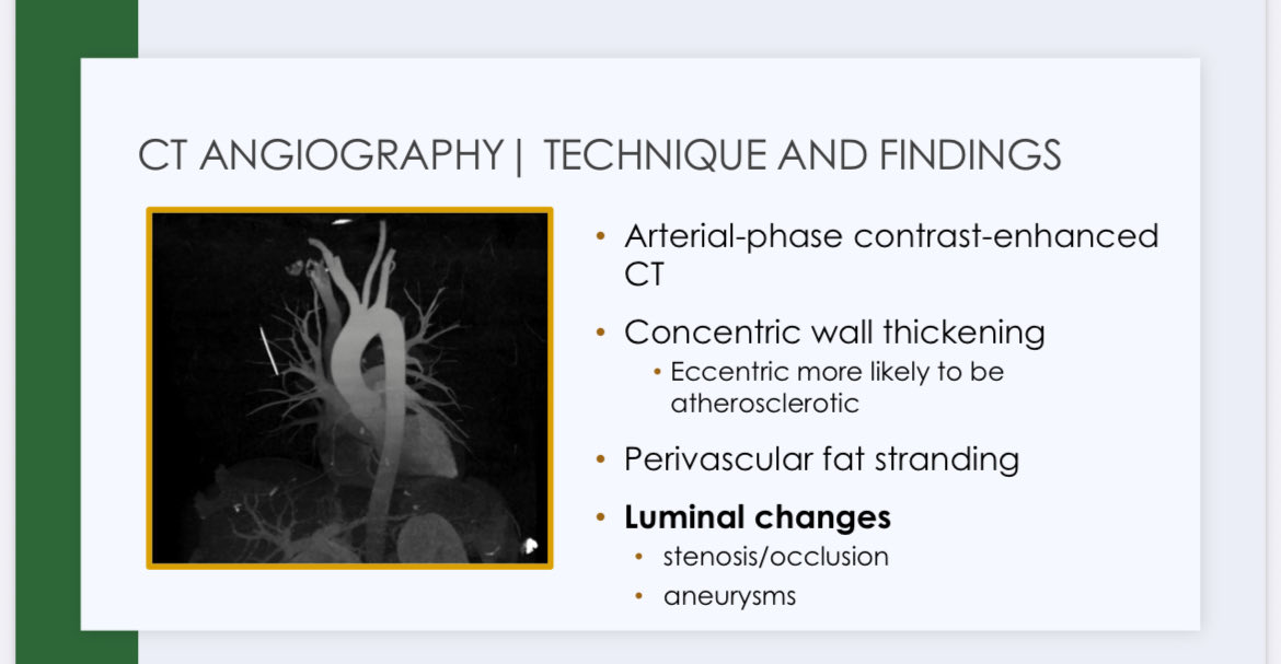 RoxOsler's tweet photo. Radiology Bootcamp #ACR25 Imaging of large vessel vasculitis (I)
🔹Ultrasound ➡️first-line, shows halo sign and stenosis.
🔹 CTA ➡️high resolution for anatomy &amp; complications. https://t.co/BTyfORod1a