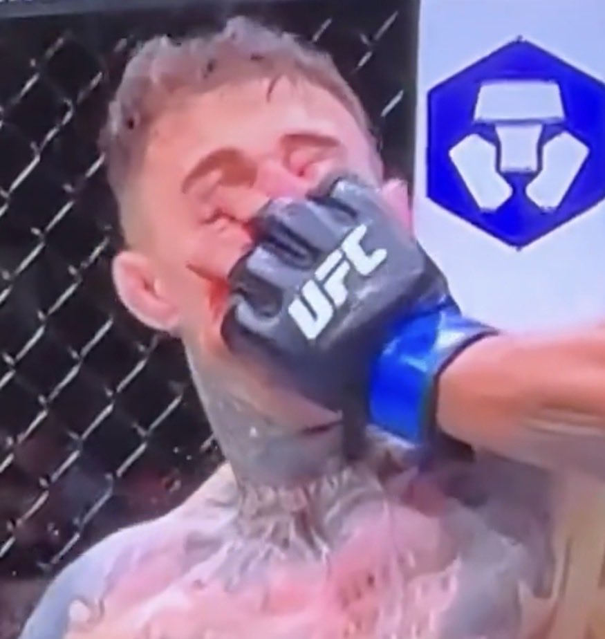 GrubberTrades's tweet photo. How the fuck are you going to boo Tom for this? Boo the frog eating fuck #ufc321 https://t.co/TmvTBoT3qS