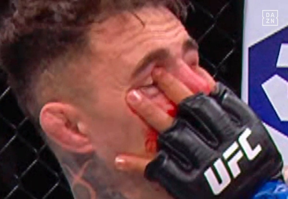 Unintentional foul💀💀
#UFC321