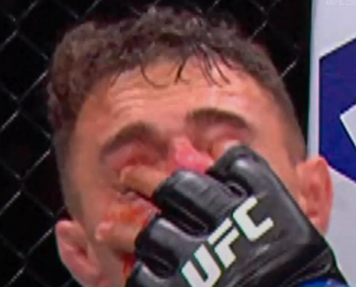 OmerOsman200's tweet image. My goodness Ciryl Gane really dug his fingers deep in Tom Aspinall's eyes.
What the .......
#UFC321
