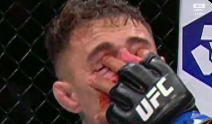 TrillDame's tweet image. “Tom Aspinall was looking for a way out of his fight vs Ciryl Gane”. Stfu this is worse than Jon Jones eye pokes lol.