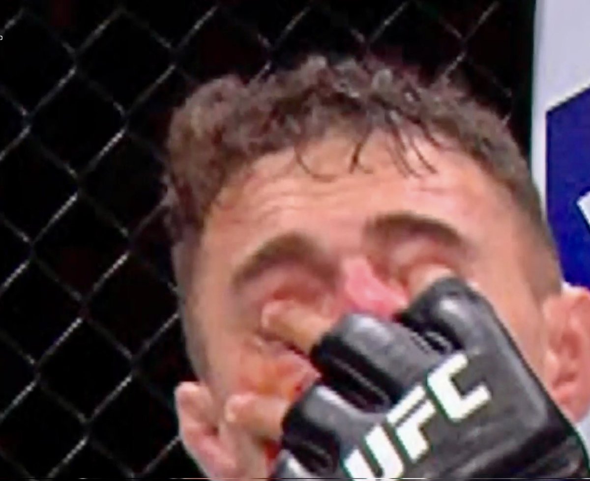 "Not an Eyepoke"
#UFC321