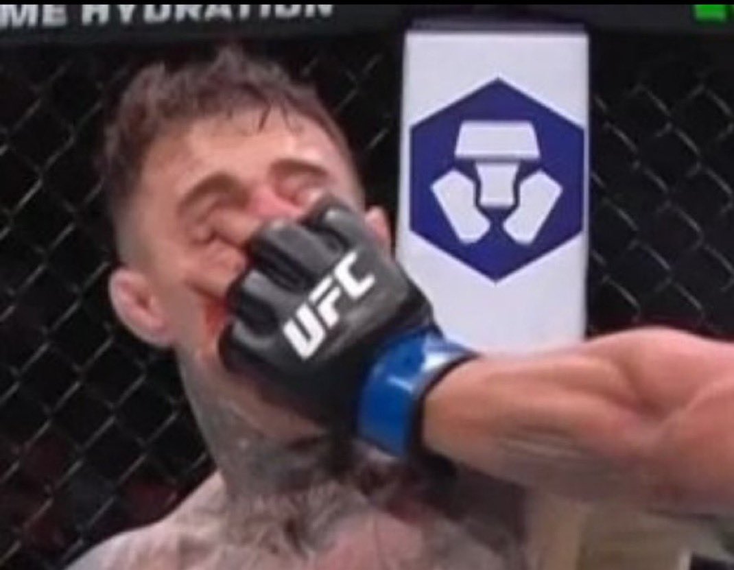 There’s no fucking way you do a DOUBLE eye poke accidentally. Blatant cheating from Gane. 

Just makes the decision to keep Aspinall waiting all this time for a title defence even more stupid.