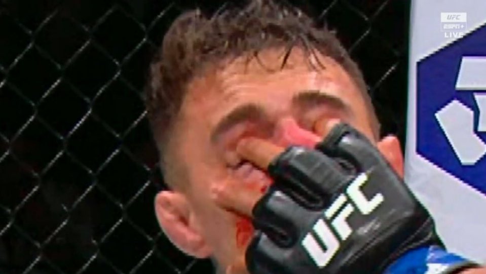 UFCRosterWatch's tweet photo. Early stoppage https://t.co/9VUfvEdl9f