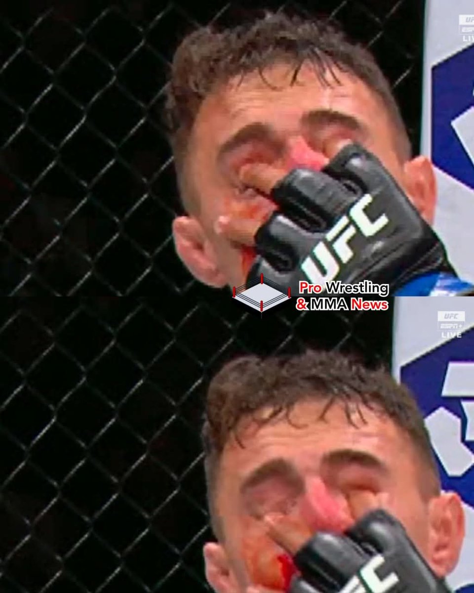 Here is a closer look at Tom Aspinall getting double-fingered poked in the eyes, with one of them being knuckle-deep. #UFC321