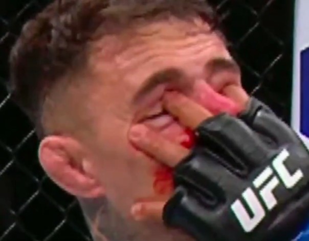 fuego773's tweet photo. @HomelanderrMMA https://t.co/sPpDhprJso