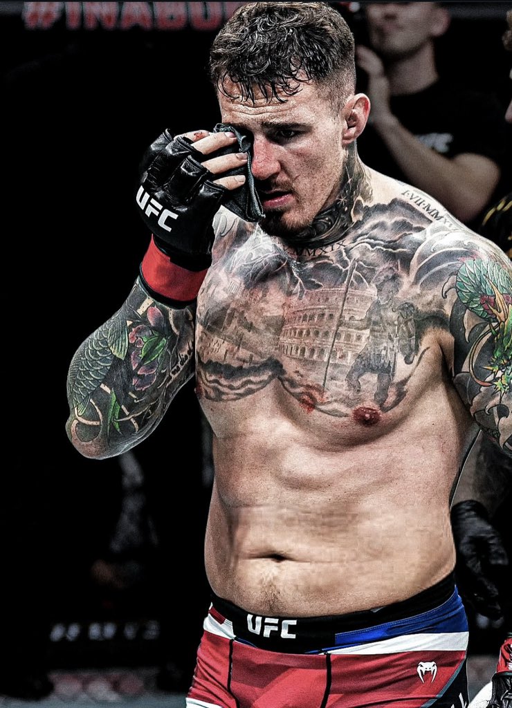 عاجل نقل توم اسبينال ل المستشفى الان 🥲🏥