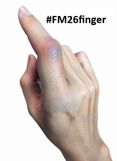 therealgoodall's tweet photo. UK doctors dealing with a barrage of of appointments for this next week!!

#FM26 #FM26beta #FM26finger https://t.co/tZZuiveXF4