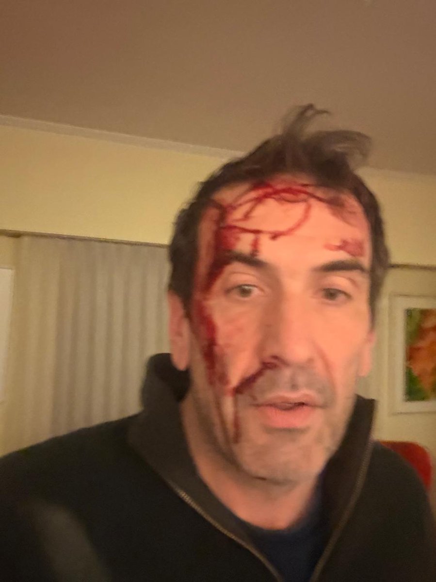 Neuquén AHORA
ENTRADERA VIOLENTA 
A horas del inicio de los comicios, asaltaron violentamemte al diputado nacional y candidato Pablo Cervi.
Entaba en su casa junto a la familia. Recibio varios golpes y le gatillaron 3 veces un arma de fuego que afortunadmente  no se disparo.