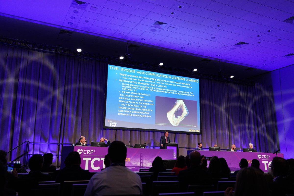 Kicking off #TCT2025 in San Francisco, top talks, new tech, and great people. Huge opportunity to learn and grow in this field.