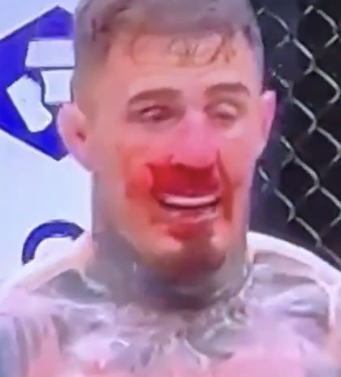 Curtis blaydes is a fat slob that doesn’t know his left foot from his right…..

Here’s how he looked in there with someone that isn’t downs.