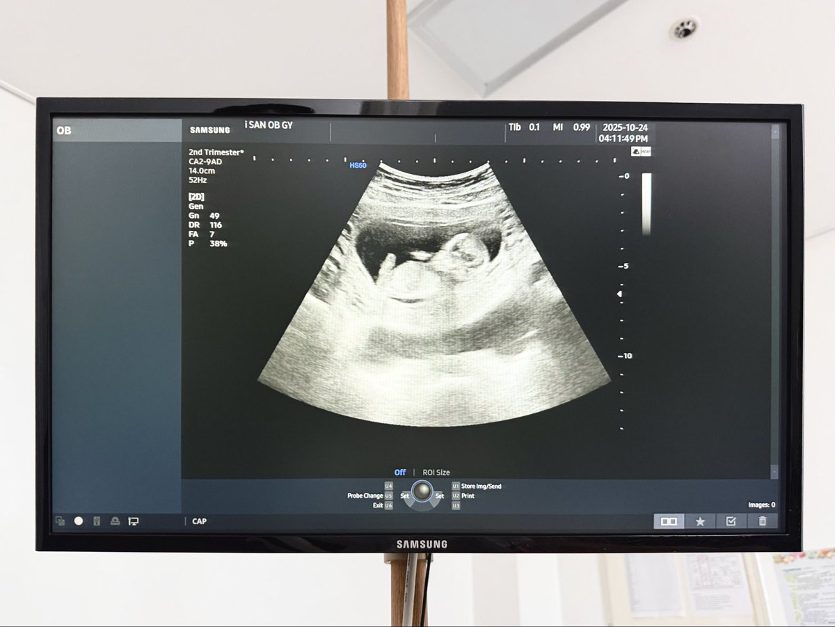 근황. 첫째의 첫 생일이 지나고 둘째가 생겼다. 매일 육아+집안일+임신 증상(입덧, 하복부 통증 등등)을 겪으며 남편의 도움과 함께 하루 하루 간신히 사는 중. 죽을 것 같다.