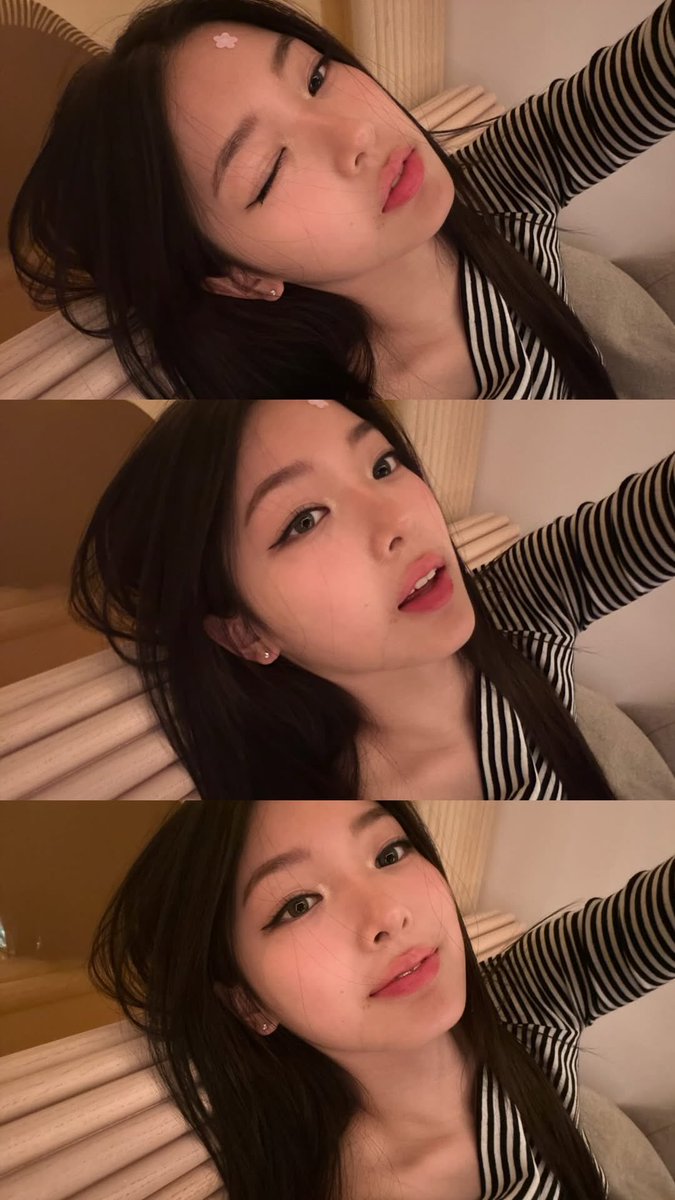 severe case of pretty face syndrome