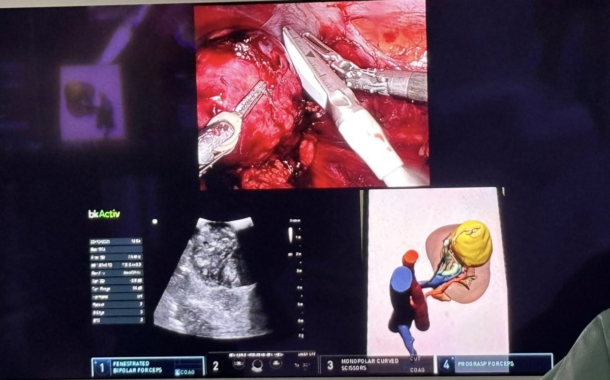 Bernardo Herrera Imbroda tweet media