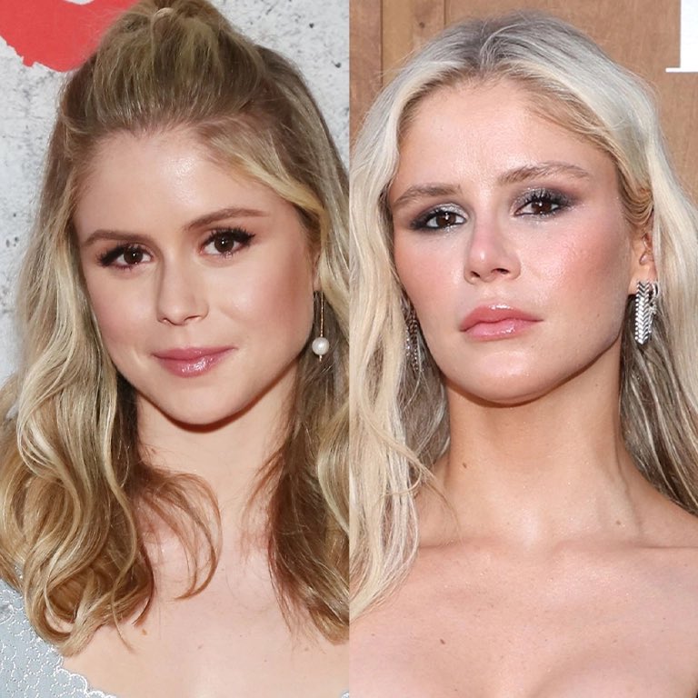 If she didn’t get plastic surgery, why did you block me like a coward, <a href="/that_dndgirl/">Becca, Scout's Best Girl</a> ? Btw, she clearly did 🤡🤦