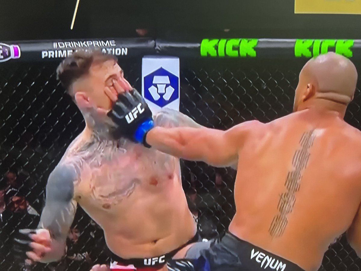 People who is saying that Aspinall should continue fight after this is diabolical! 

If this can happen with fighter continuing EVERYONE SHOULD POKE EYES AND BE LIKE OH SHIT SORRY…

#UFC321