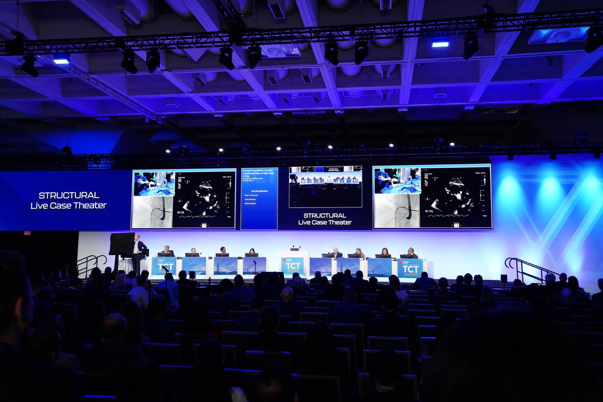 Live from #TCT2025 

Tricuspid Transcatheter Edge-to-Edge Repair (TriClip) by the team at Intermountain Medical Center, Salt Lake City.
<a href="/TCTMD/">TCTMD</a> <a href="/crfheart/">Cardiovascular Research Foundation</a>