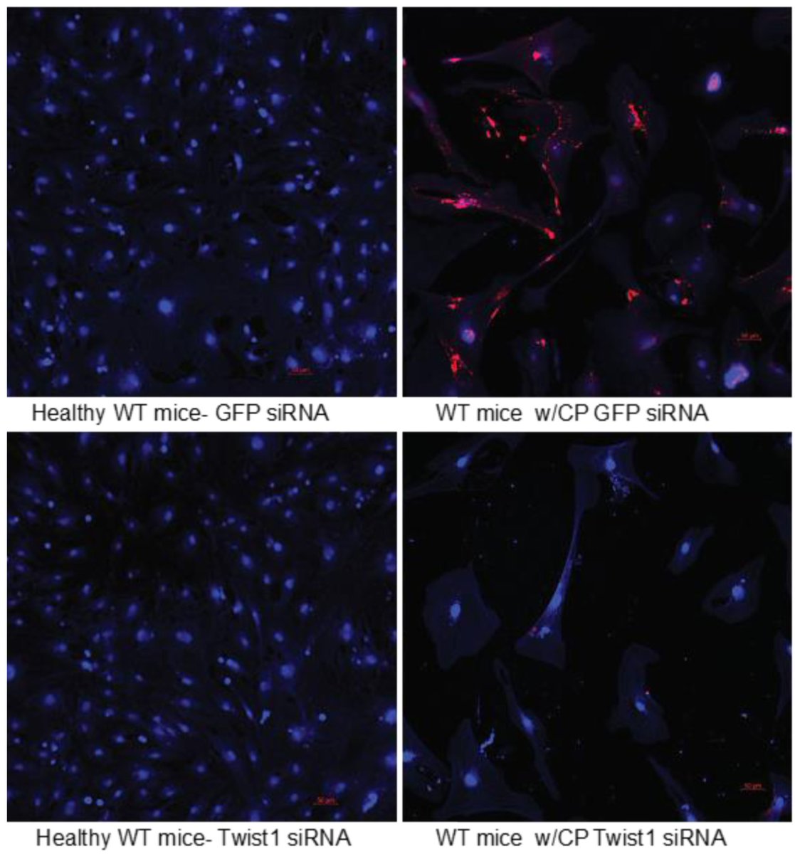 AJPathology's tweet image. #LegacyContent: The Role of Twist1 in Chronic Pancreatitis–Associated Pancreatic Stellate Cells.  Authors from @AUG_University
#OpenAccess text: ajp.amjpathol.org/article/S0002-…