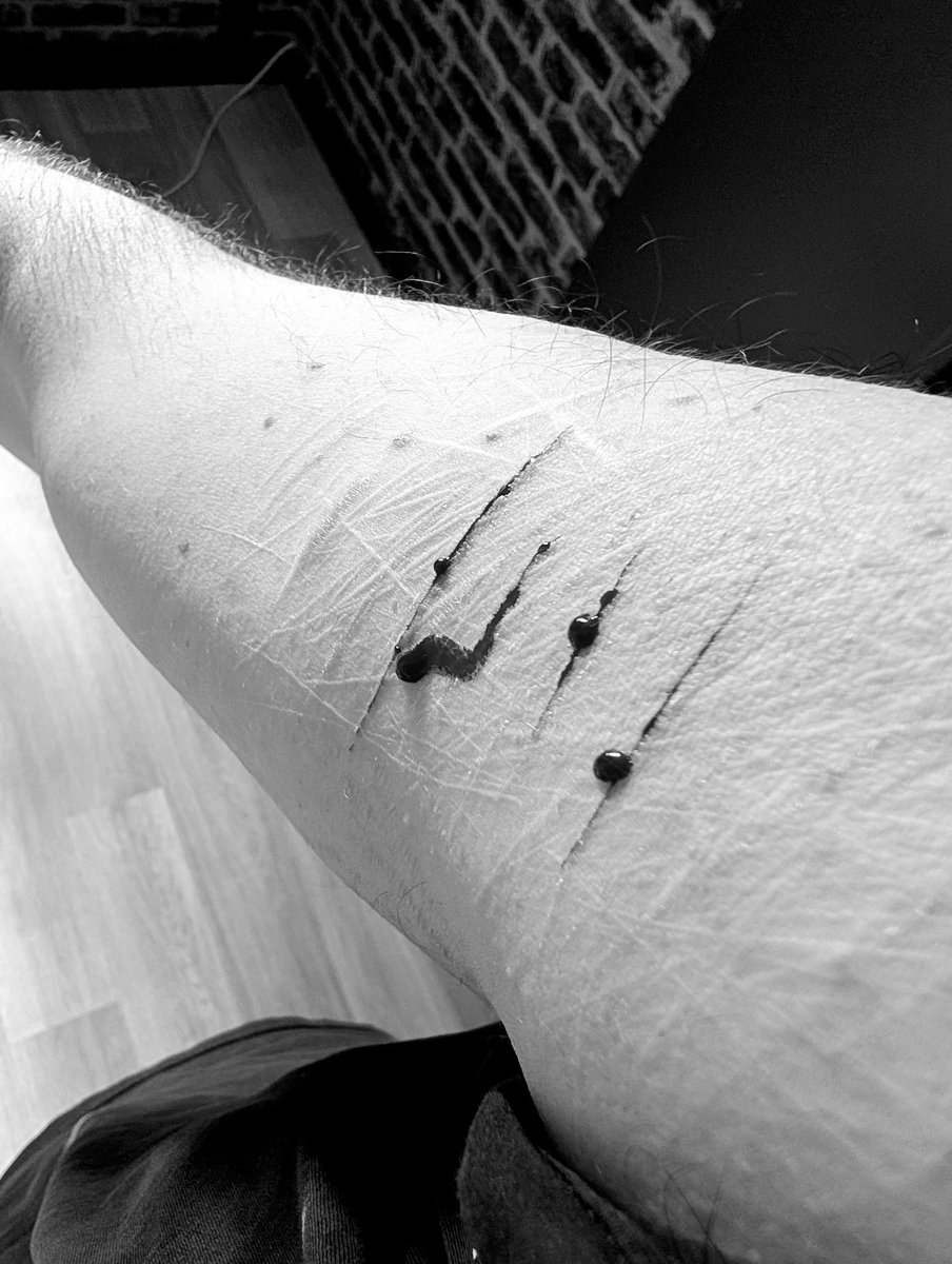 Is it safe ? 
Absolutly 
#selfharm #SELFHARMTRIGGERWARNING #sfh #selfharms