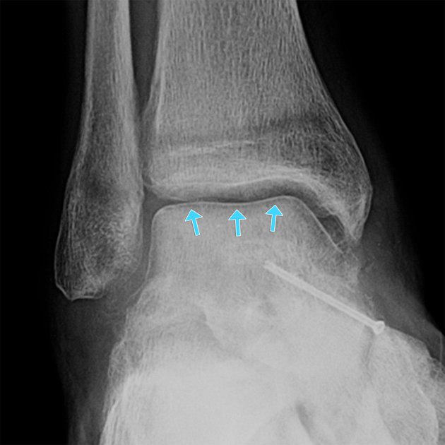 medflutter_'s tweet image. Name the sign!