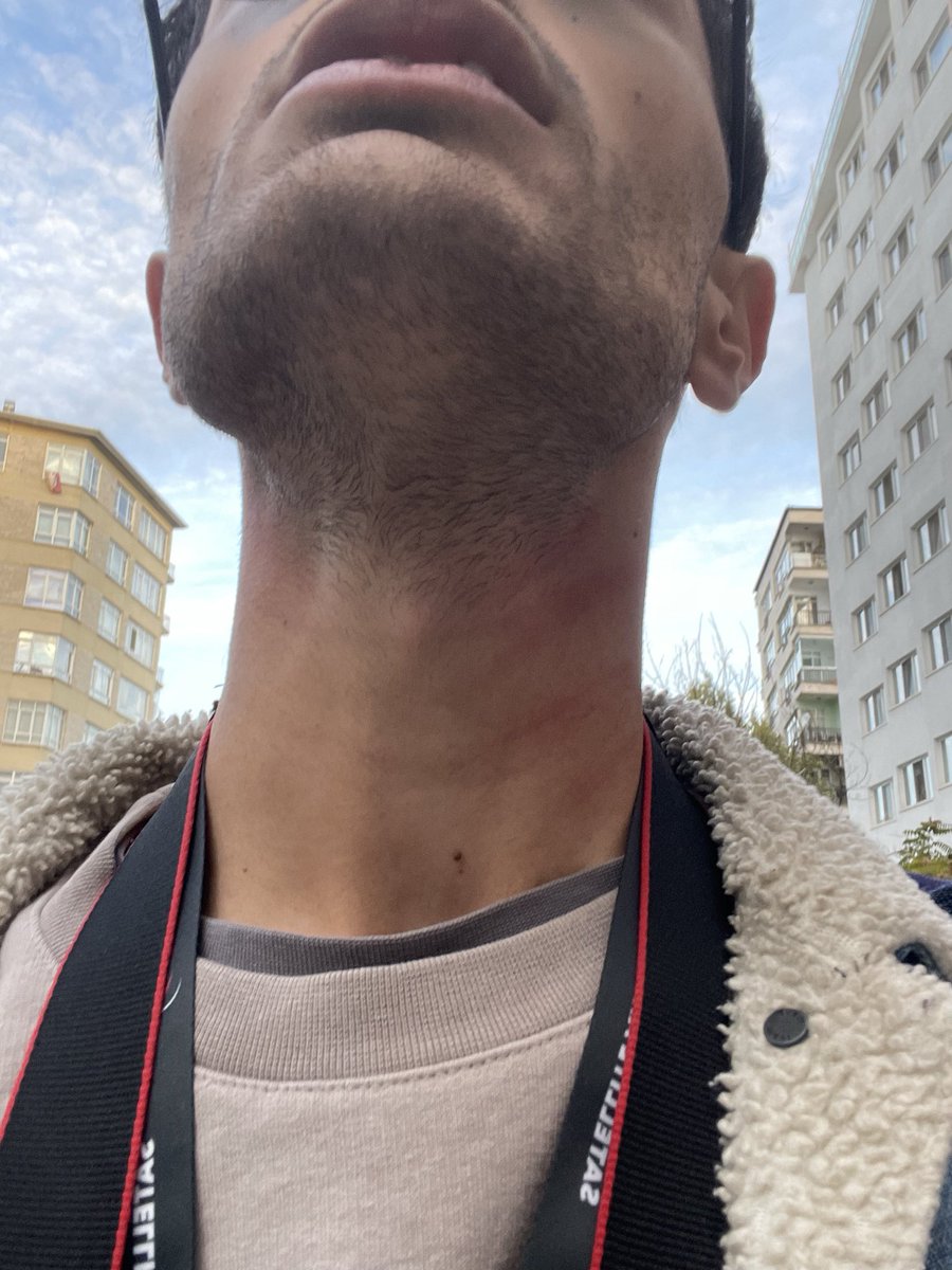 Boğazım anlık, teşekkürler beyefendi.