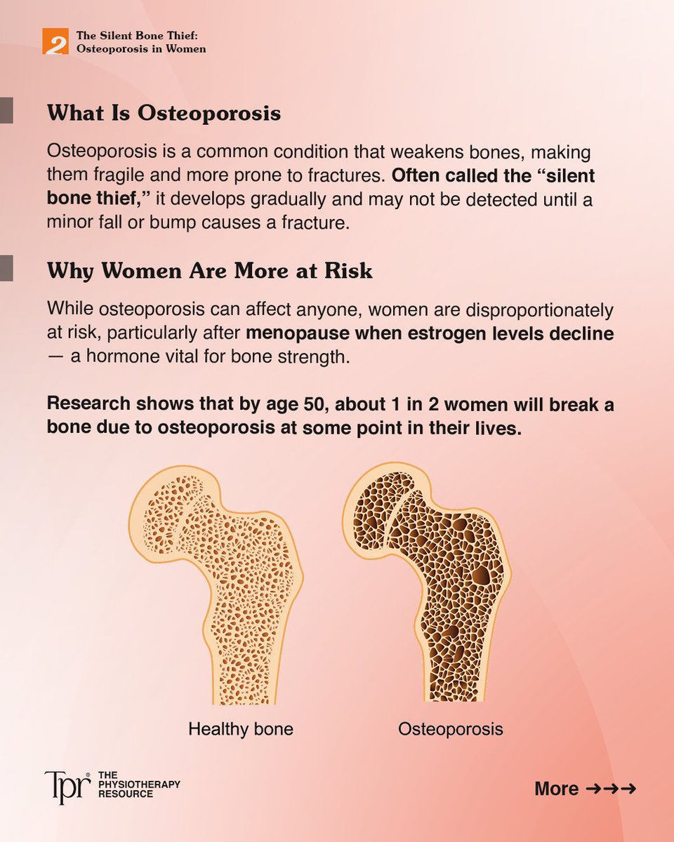 The_P_Resource's tweet photo. The Silent Bone Thief: Osteoporosis in Women 🦴💔

Osteoporosis silently weakens bones, increasing fracture risk. 💪 But knowledge is power! Swipe to learn about:

✅ Osteoporosis risks and symptoms
✅ Exercise and nutrition for bone health https://t.co/JtsOuiM69M