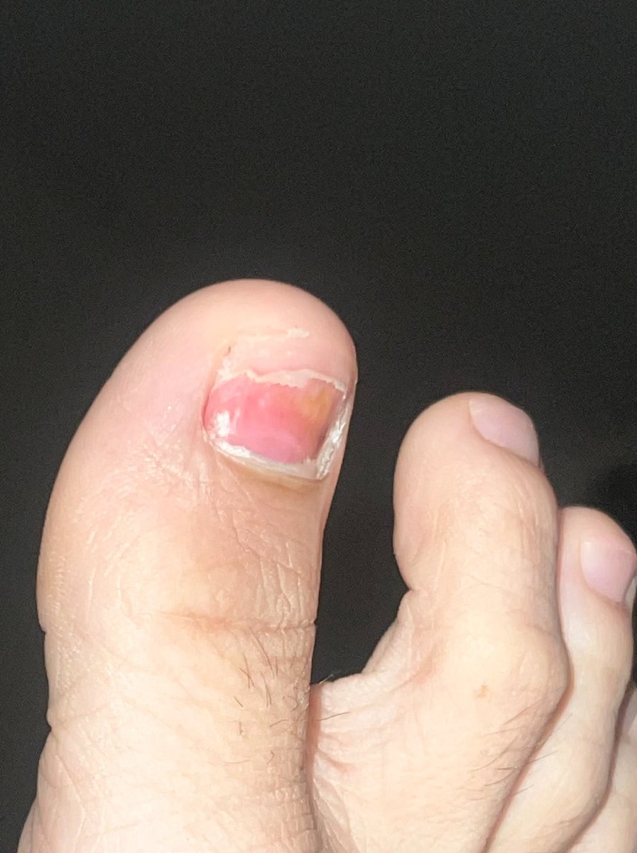 แบบนี้กี่วันงอก🙂‍↔️