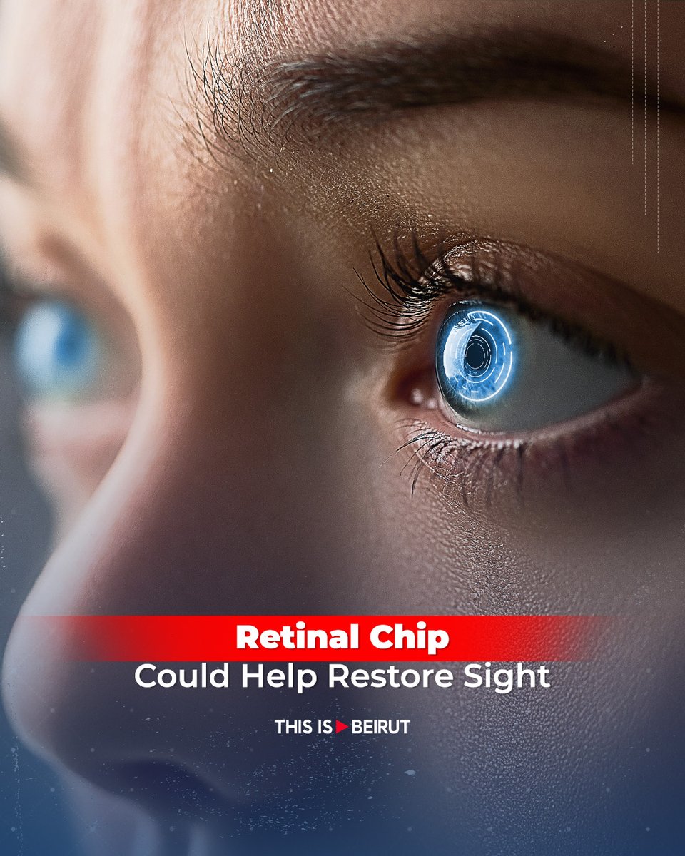 ThisIsBeirut_'s tweet image. People with macular degeneration gradually lose the center of their #vision, the part that lets them read, recognize faces and see details.

Now, a new #medical breakthrough is bringing some of that vision back.

A tiny chip placed under the #retina, combined with special