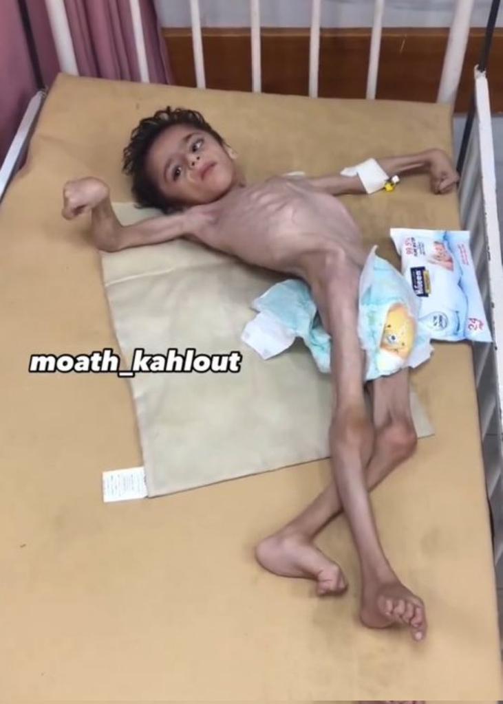 Stop for just five seconds... If you can't donate, there's another option:

1. Leave a dot. Just a tiny dot but it might scream louder than silence

As for passing by in silence perhaps you should reconsider your humanity
chuffed.org/project/138261…