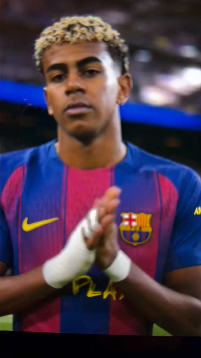 darthborder's tweet photo. @Neiraelvikingo Comienzo partido tiene venda en mano derecha, en el minuto 15 ya no la tiene, porqué?? https://t.co/HQnDqEF8qR