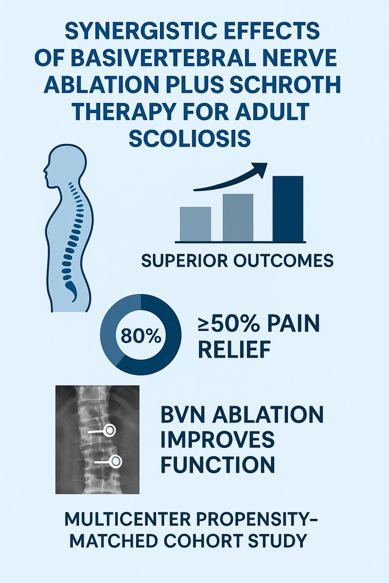 kcodonkorGH's tweet image. Excited to share our latest open-access study in Pain and Therapy:
“Synergistic Effects of Basivertebral Nerve Ablation Plus Schroth Therapy for Adult Scoliosis: A Multicenter Propensity-Matched Cohort Study.”
link.springer.com/article/10.100…