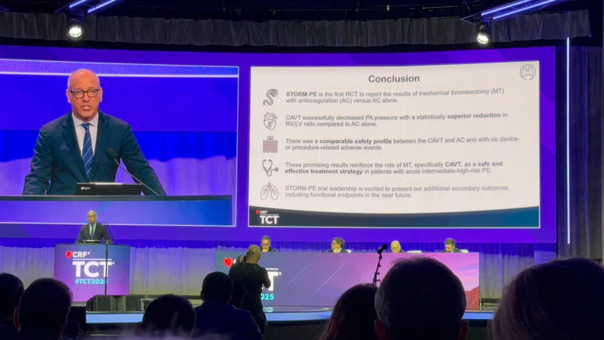 Live <a href="/MountSinaiIR/">Mount Sinai IR</a>. Our very own <a href="/roblookstein/">Robert A Lookstein MD, MHCDL</a> presenting STORM-PE; 1st RCT to report results of mechanical thrombectomy w/ AC vs AC alone #TCT2025 <a href="/SIRspecialists/">Society of Interventional Radiology</a>