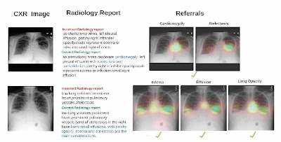 Radiology_AI's tweet photo. CoRaX #AI system helps radiologists detect abnormalities on chest radiographs https://t.co/Afcr8p176a @ComputerSociety @IEEEorg  #BHI25 #AI #health https://t.co/1GHOOpWgm4