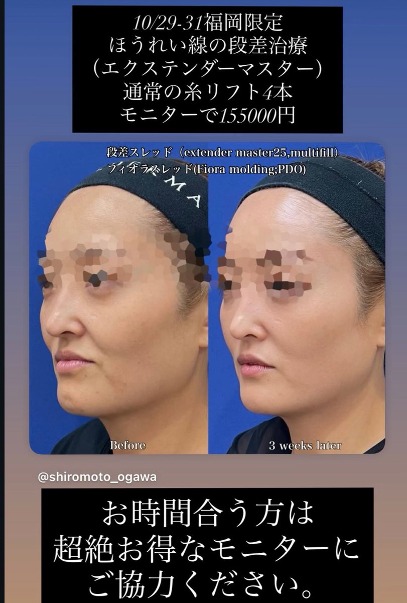 城本クリニック 総括医師 小川英朗（悪徳美容外科を許さない） on X