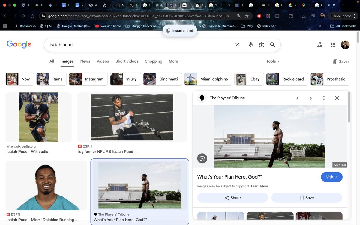 jhazani's tweet image. Just thought about #IsaiahPead #rn #interpolation