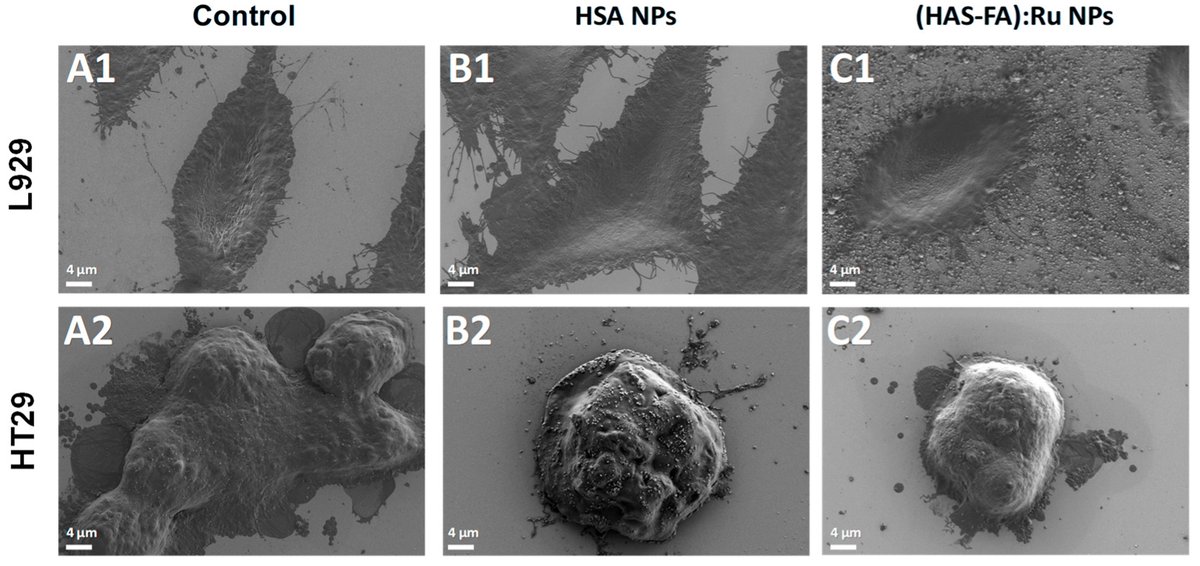 IJMS_MDPI's tweet image. 🌟#LatestPaper
 
📚Human Serum Albumin-Based #Nanoparticles for Targeted Intracellular #DrugDelivery
 
🧑‍🔬Dr. Claudia Gabriela Chilom, et al.
 
🔗Read more: mdpi.com/1422-0067/26/1…

#Albumin #FolicAcid #Intracellular #MDPIIJMS #OpenAccess