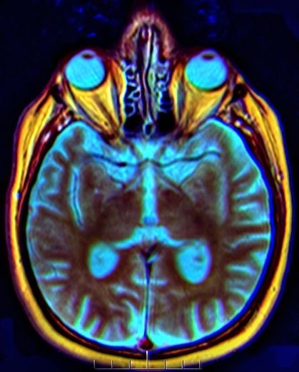 chrissfranklinn's tweet image. Imaging is no longer just diagnostic it’s predictive. Each voxel holds tomorrow’s insight.
