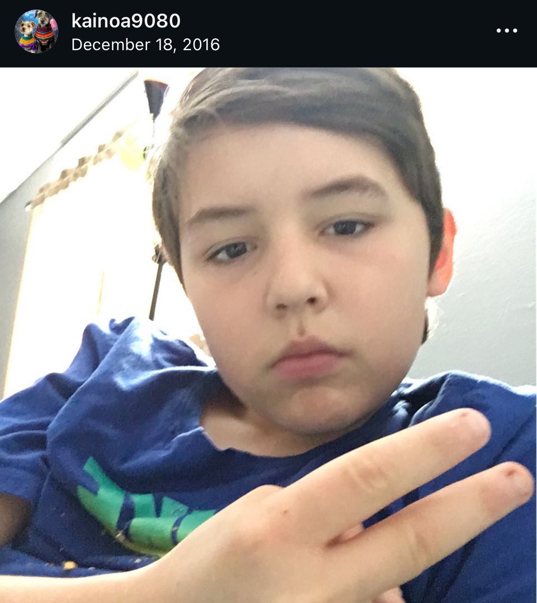 FatNUglyRoyale's tweet photo. Today, Kainoa Pikafian aka Kai Grinds aka @IGLKAI was revealed to be a poor white kid living in the slums who projects online https://t.co/m7OaWEx9cJ